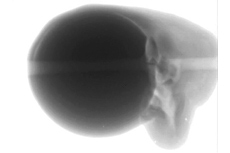 写真4-2　サンプル（2）X-Ray